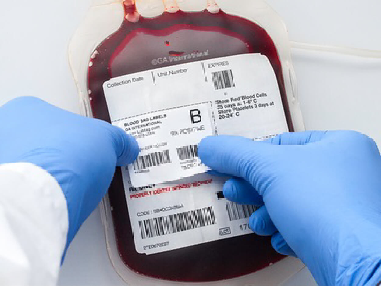 Донорство эритроцитов. Этикетка пакета с кровью.